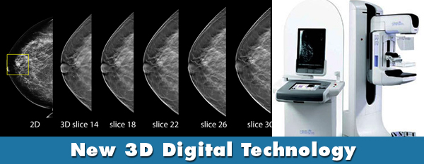 digital mammography tomosynthesis
