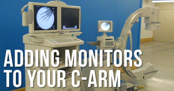 3 Options for Adding Monitors to a C-Arm